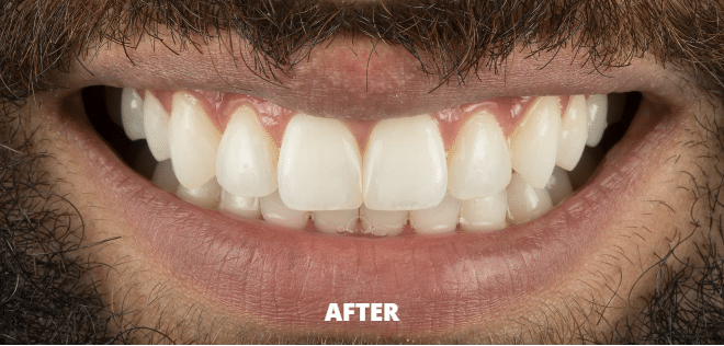 Case 4 — after