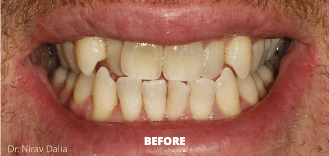 Case 2 — before