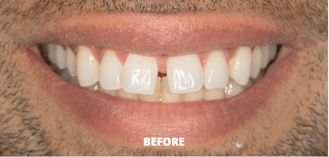 Case 4 — before